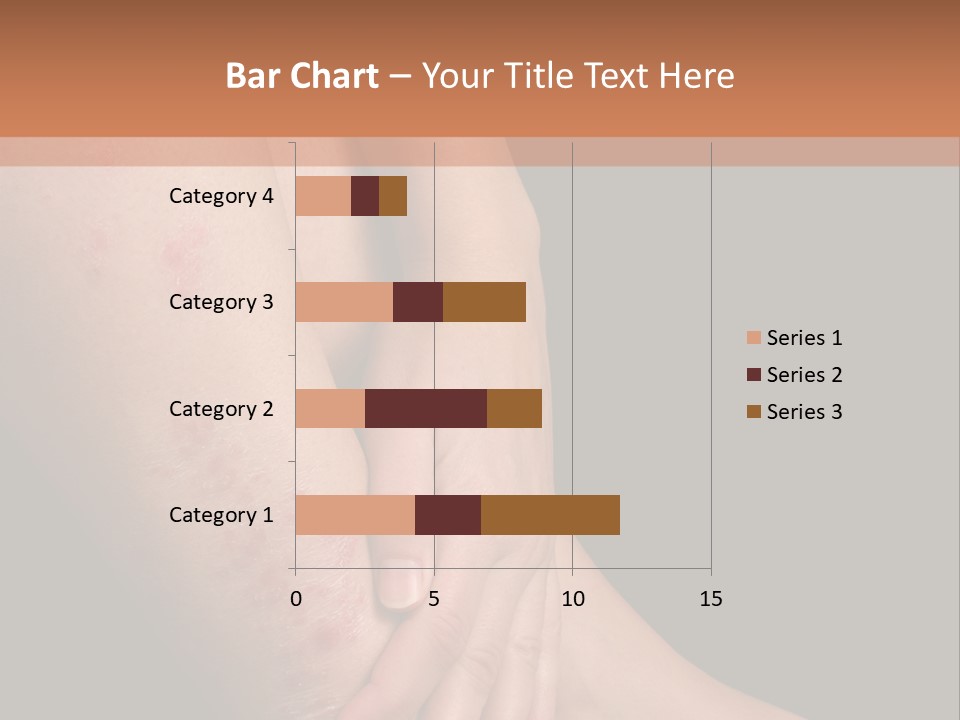 Skin Peeling Skin Condition PowerPoint Template