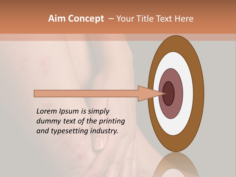 Skin Peeling Skin Condition PowerPoint Template