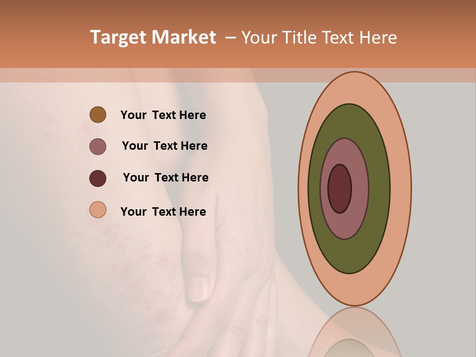 Skin Peeling Skin Condition PowerPoint Template