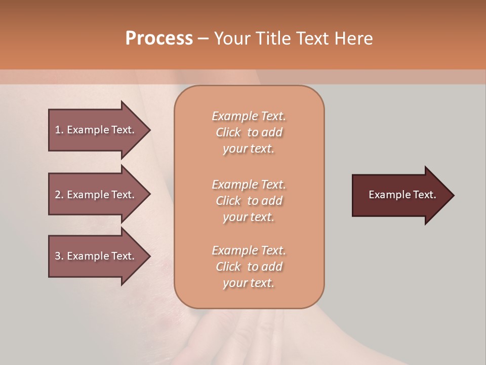 Skin Peeling Skin Condition PowerPoint Template