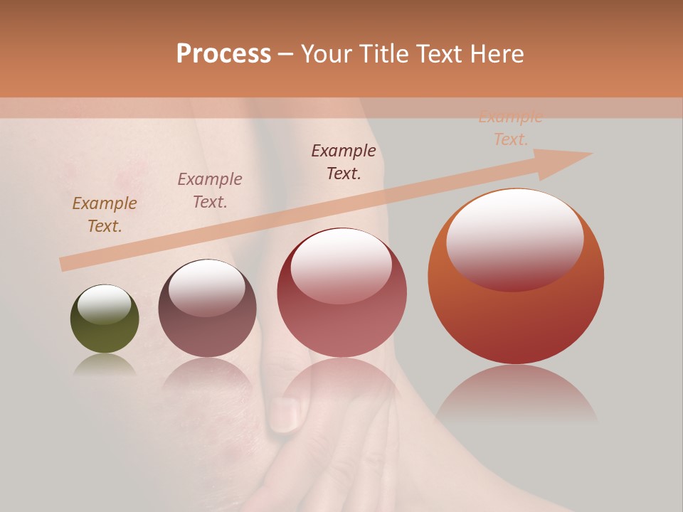 Skin Peeling Skin Condition PowerPoint Template