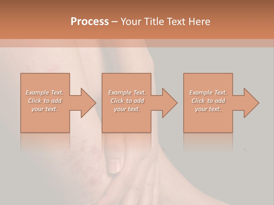 Skin Peeling Skin Condition PowerPoint Template