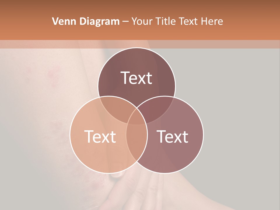 Skin Peeling Skin Condition PowerPoint Template