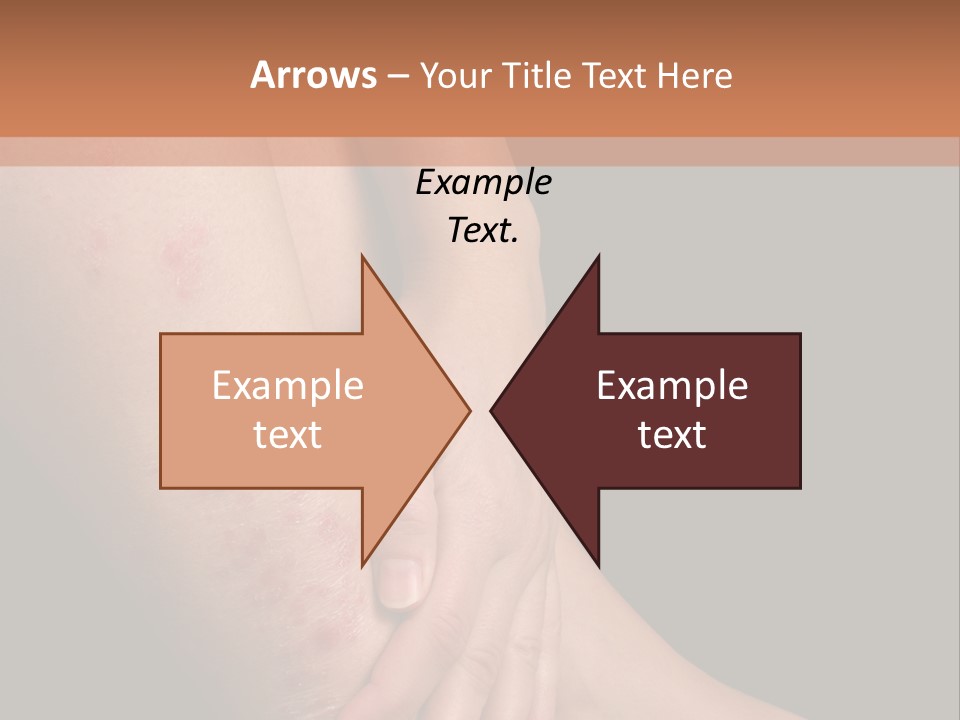 Skin Peeling Skin Condition PowerPoint Template