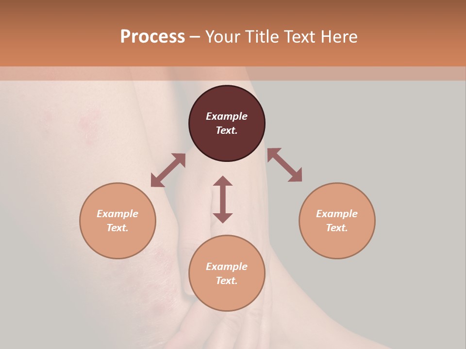 Skin Peeling Skin Condition PowerPoint Template