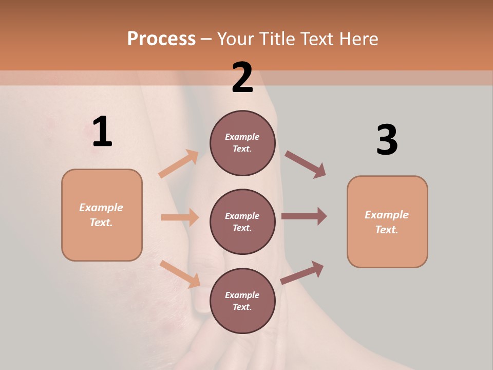 Skin Peeling Skin Condition PowerPoint Template