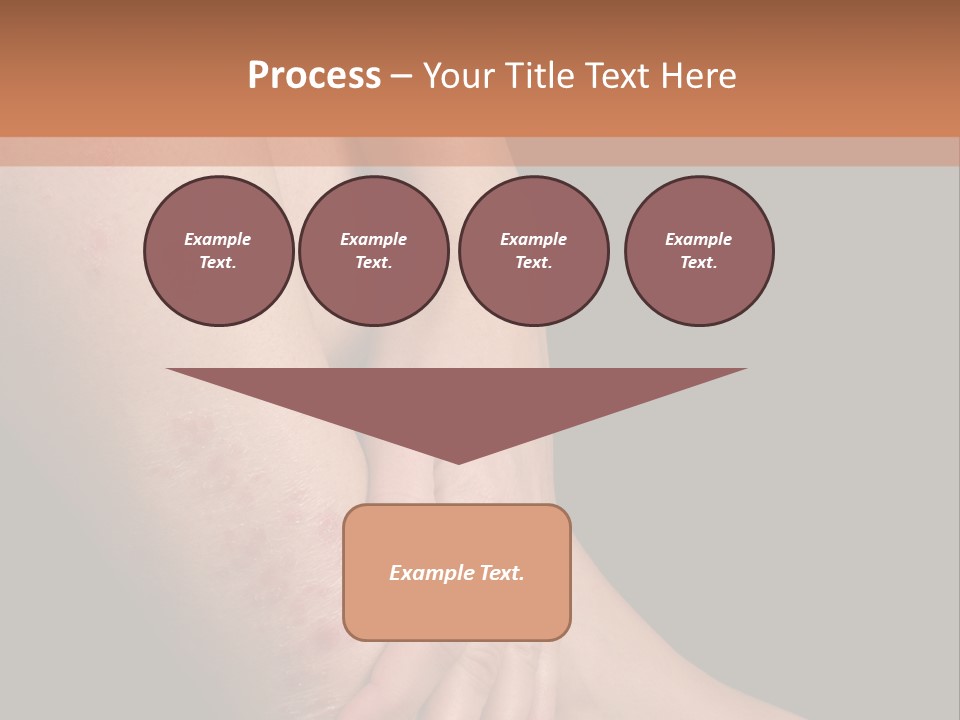 Skin Peeling Skin Condition PowerPoint Template