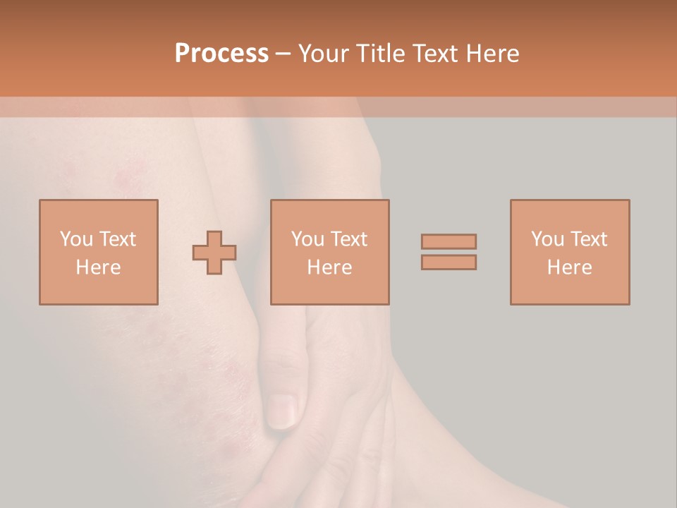 Skin Peeling Skin Condition PowerPoint Template