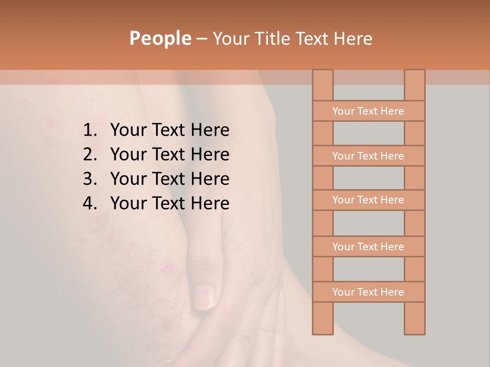 Skin Peeling Skin Condition PowerPoint Template