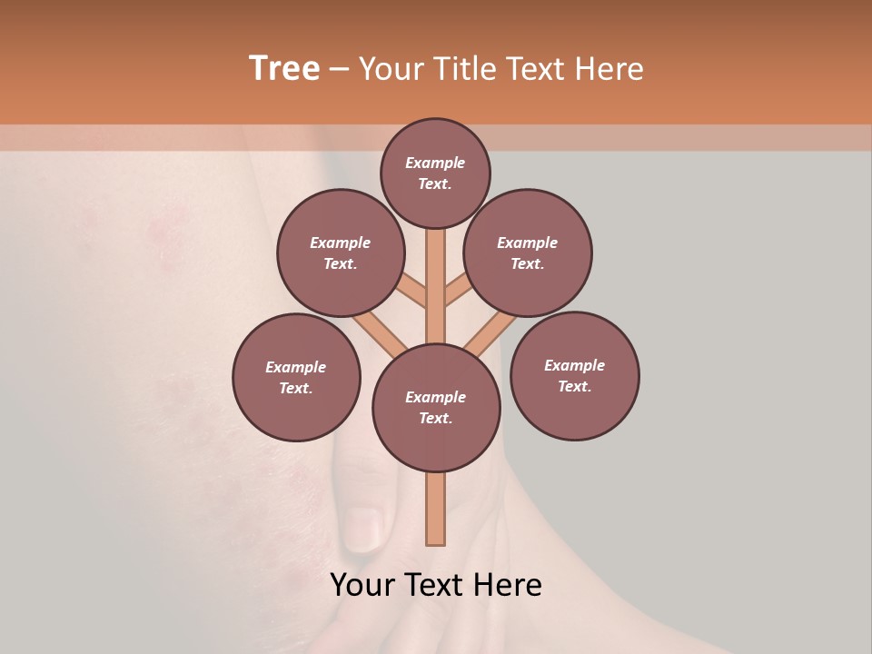 Skin Peeling Skin Condition PowerPoint Template