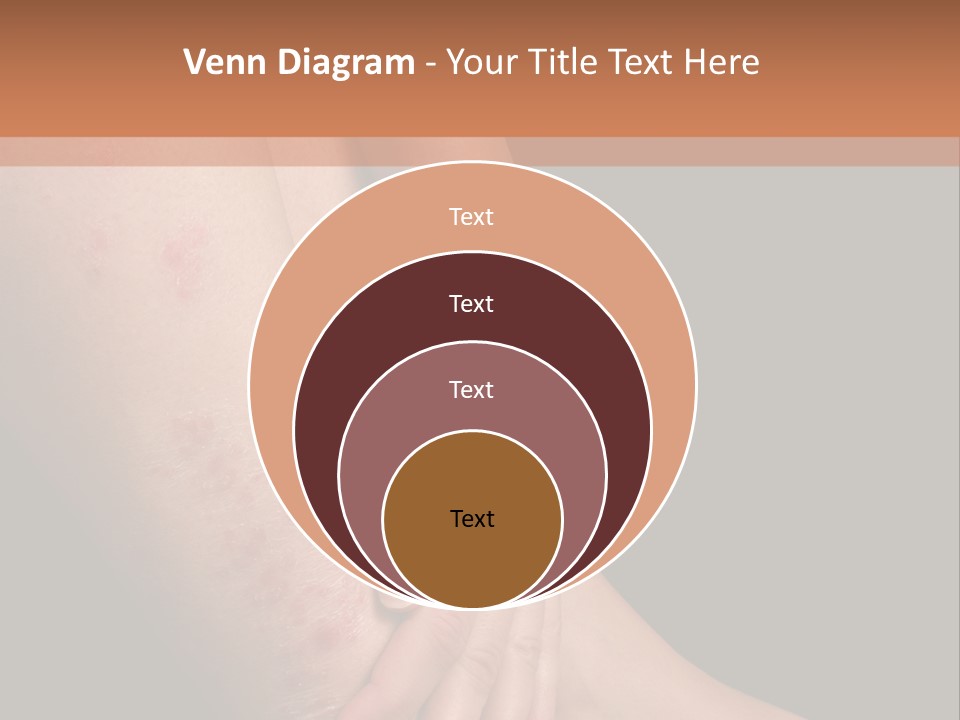 Skin Peeling Skin Condition PowerPoint Template