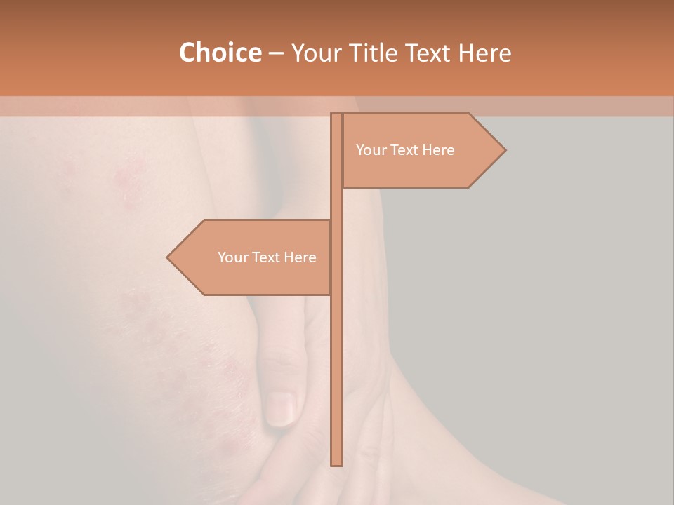 Skin Peeling Skin Condition PowerPoint Template