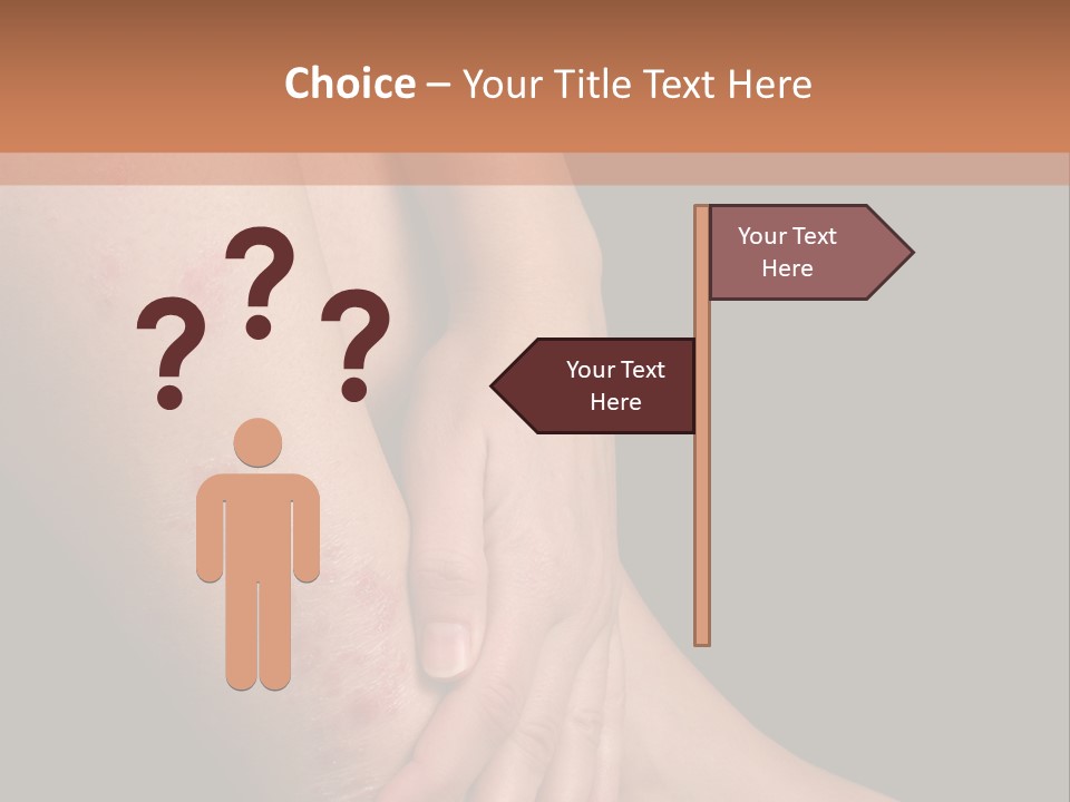 Skin Peeling Skin Condition PowerPoint Template