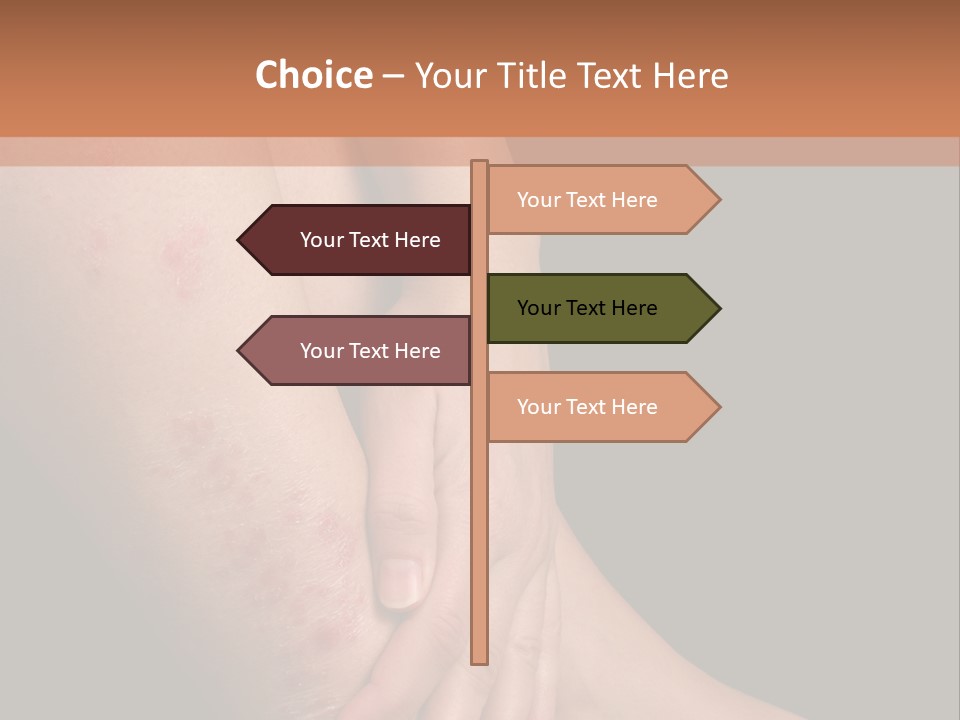 Skin Peeling Skin Condition PowerPoint Template