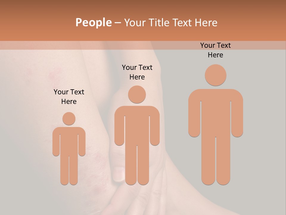 Skin Peeling Skin Condition PowerPoint Template