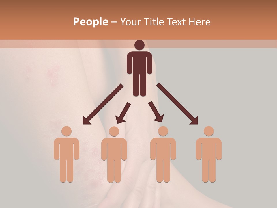 Skin Peeling Skin Condition PowerPoint Template