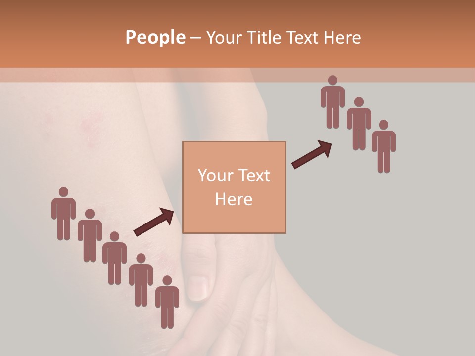 Skin Peeling Skin Condition PowerPoint Template