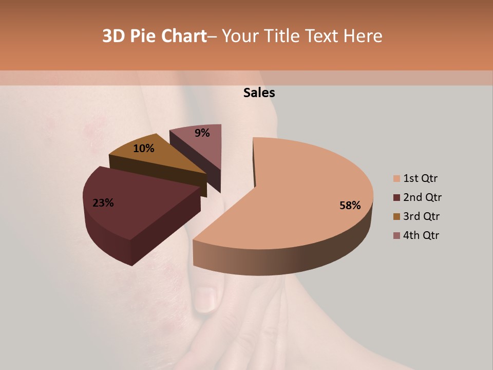 Skin Peeling Skin Condition PowerPoint Template
