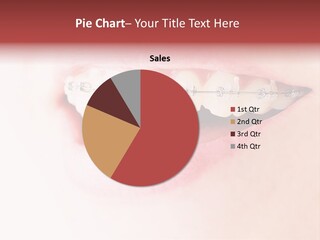 Oral Tooth Orthodontist PowerPoint Template