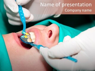 Stomatology Caries Saliva PowerPoint Template