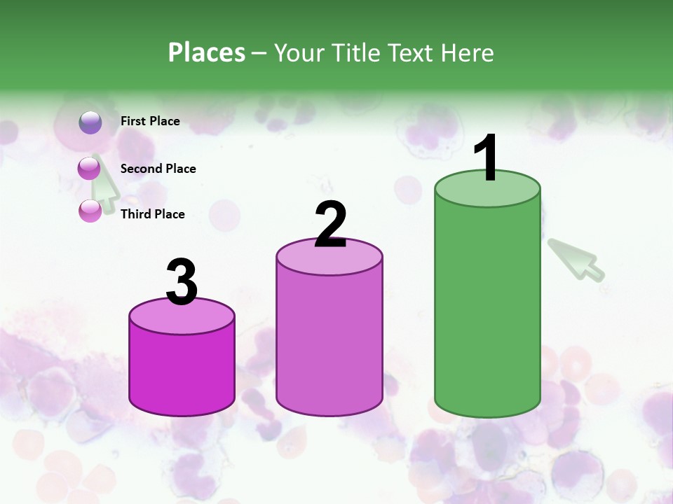 Fluid Antinuclear Sle PowerPoint Template