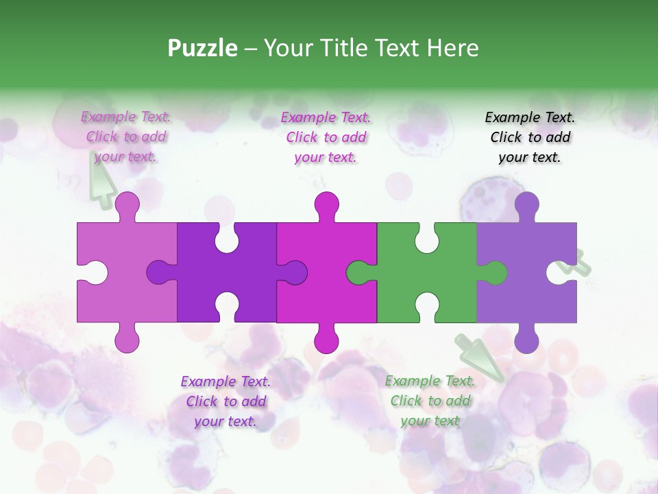 Fluid Antinuclear Sle PowerPoint Template