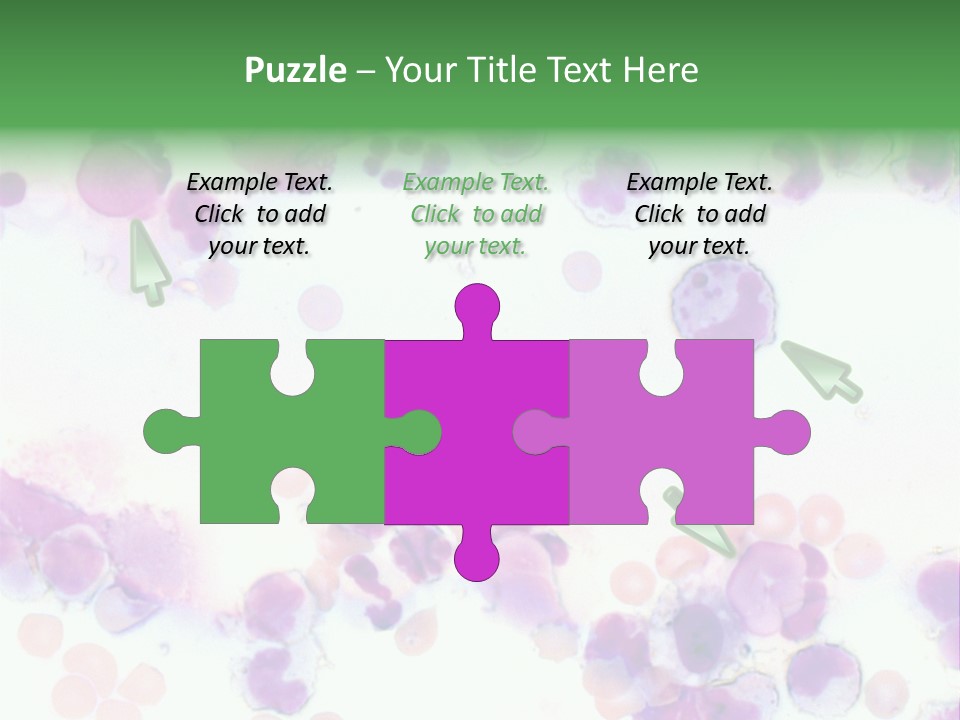 Fluid Antinuclear Sle PowerPoint Template