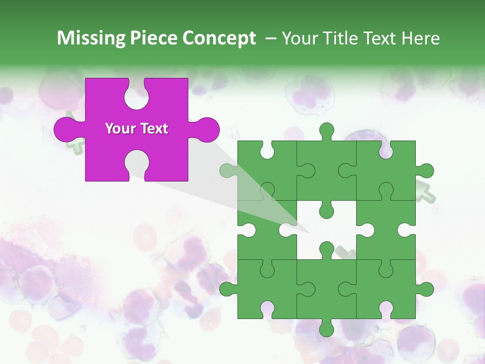 Fluid Antinuclear Sle PowerPoint Template