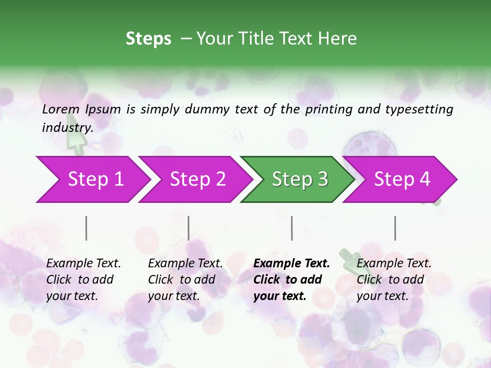Fluid Antinuclear Sle PowerPoint Template