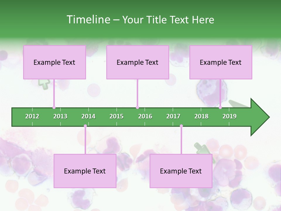 Fluid Antinuclear Sle PowerPoint Template