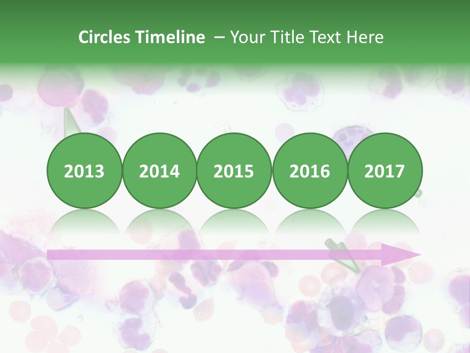 Fluid Antinuclear Sle PowerPoint Template