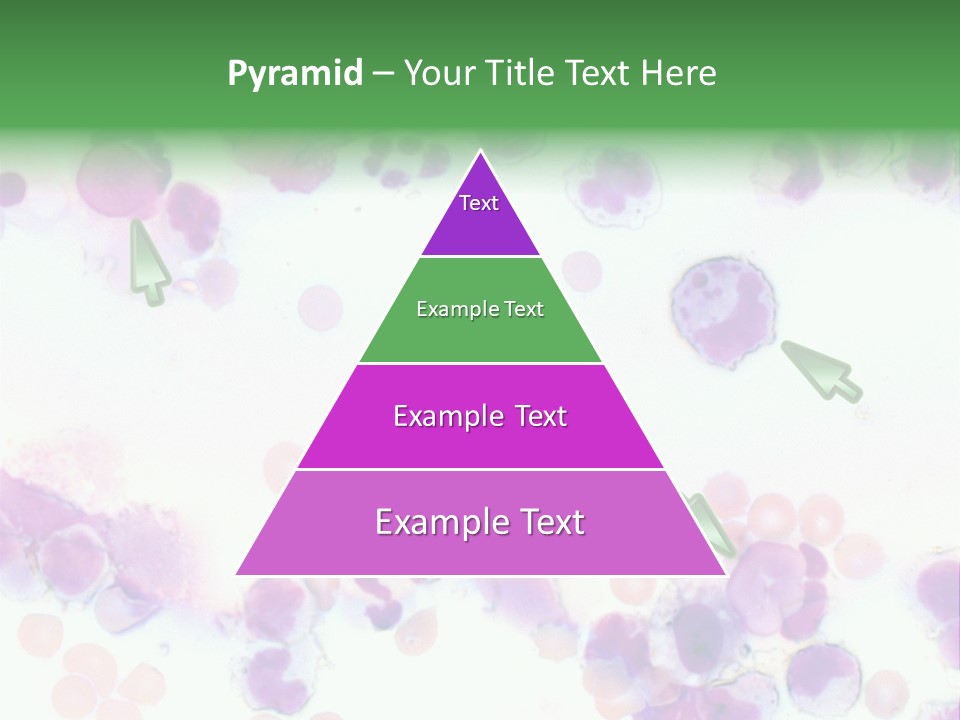 Fluid Antinuclear Sle PowerPoint Template