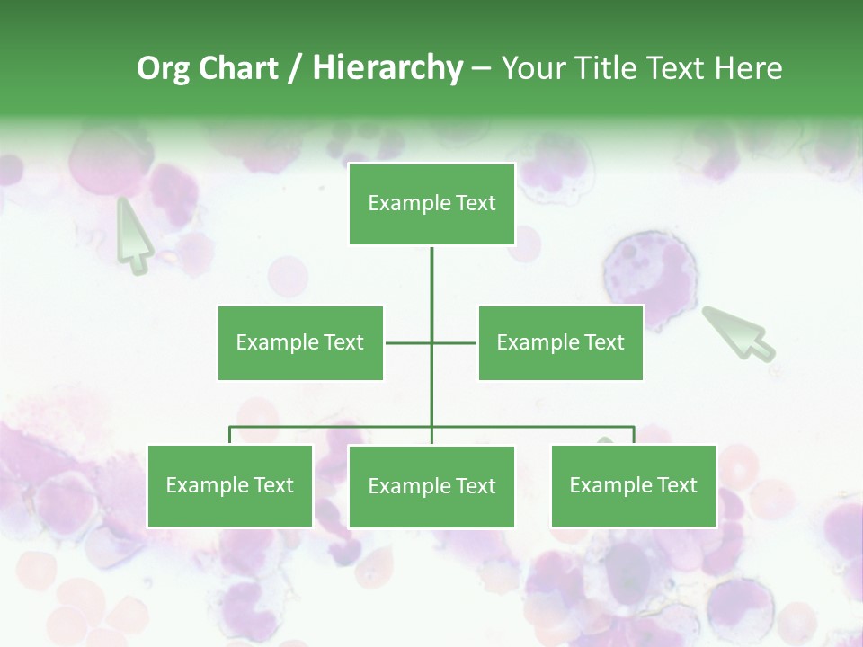 Fluid Antinuclear Sle PowerPoint Template