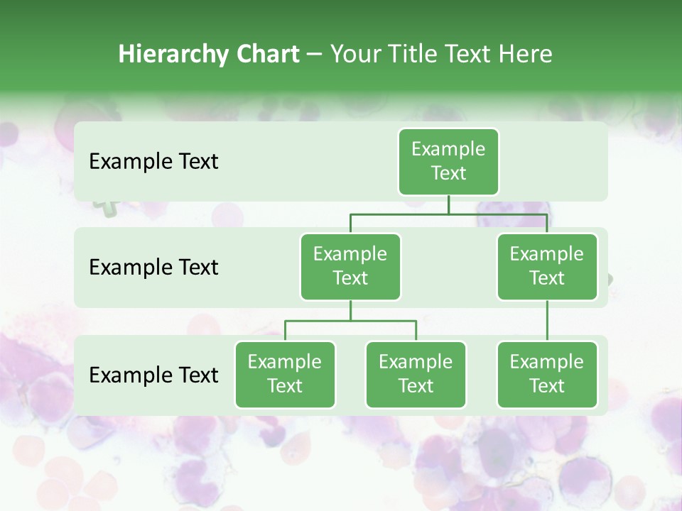 Fluid Antinuclear Sle PowerPoint Template