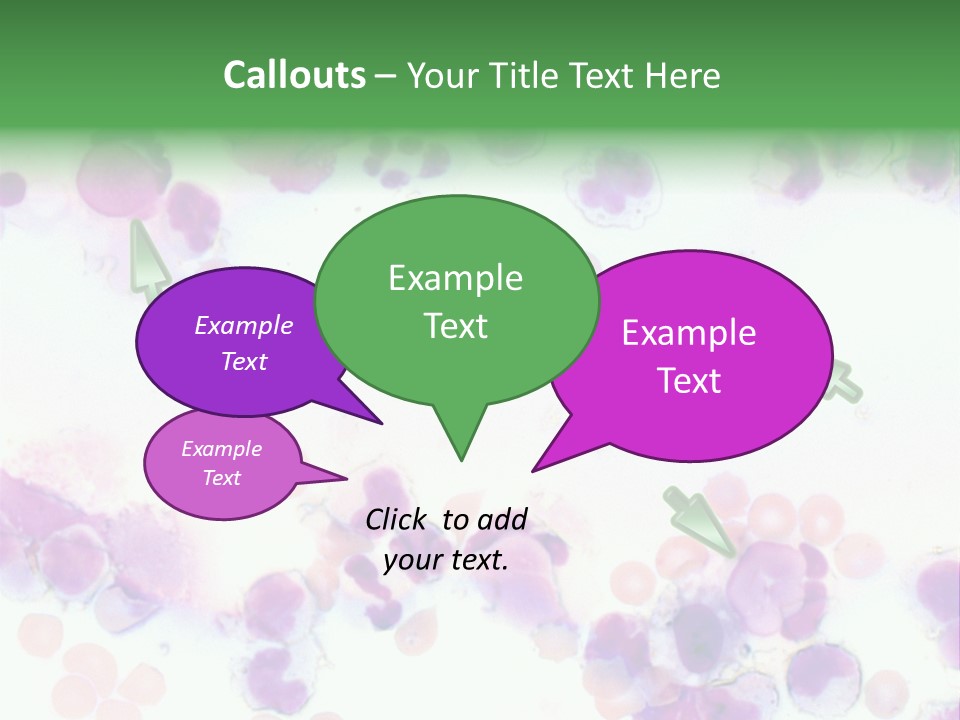 Fluid Antinuclear Sle PowerPoint Template