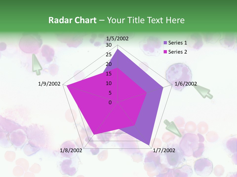 Fluid Antinuclear Sle PowerPoint Template