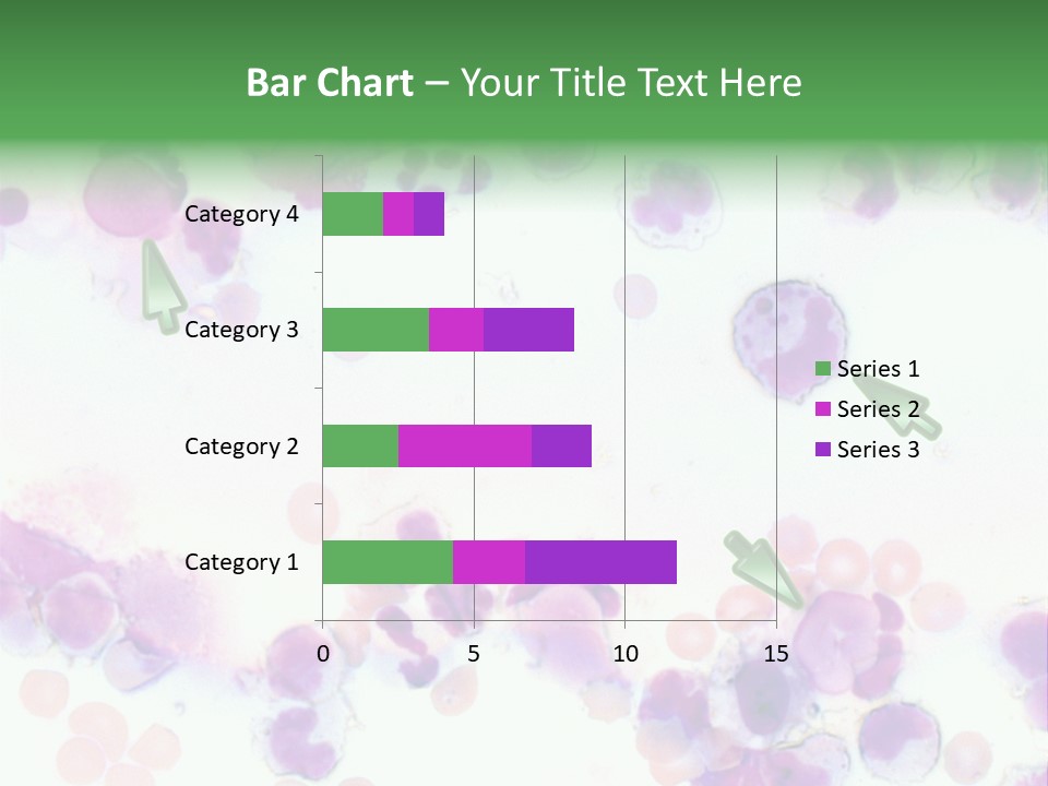 Fluid Antinuclear Sle PowerPoint Template