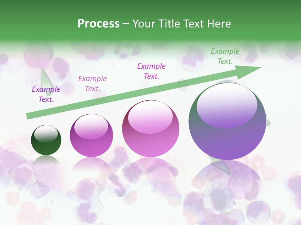Fluid Antinuclear Sle PowerPoint Template