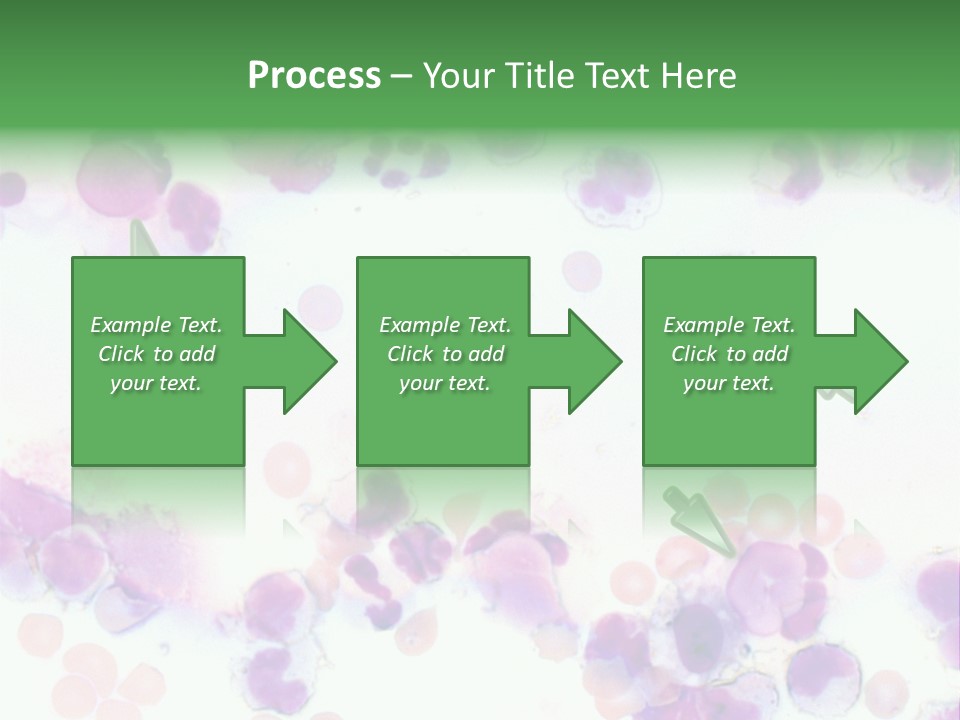 Fluid Antinuclear Sle PowerPoint Template