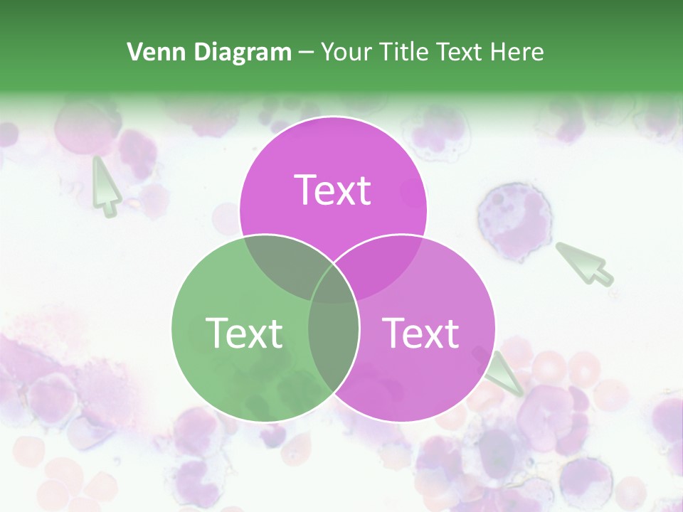 Fluid Antinuclear Sle PowerPoint Template