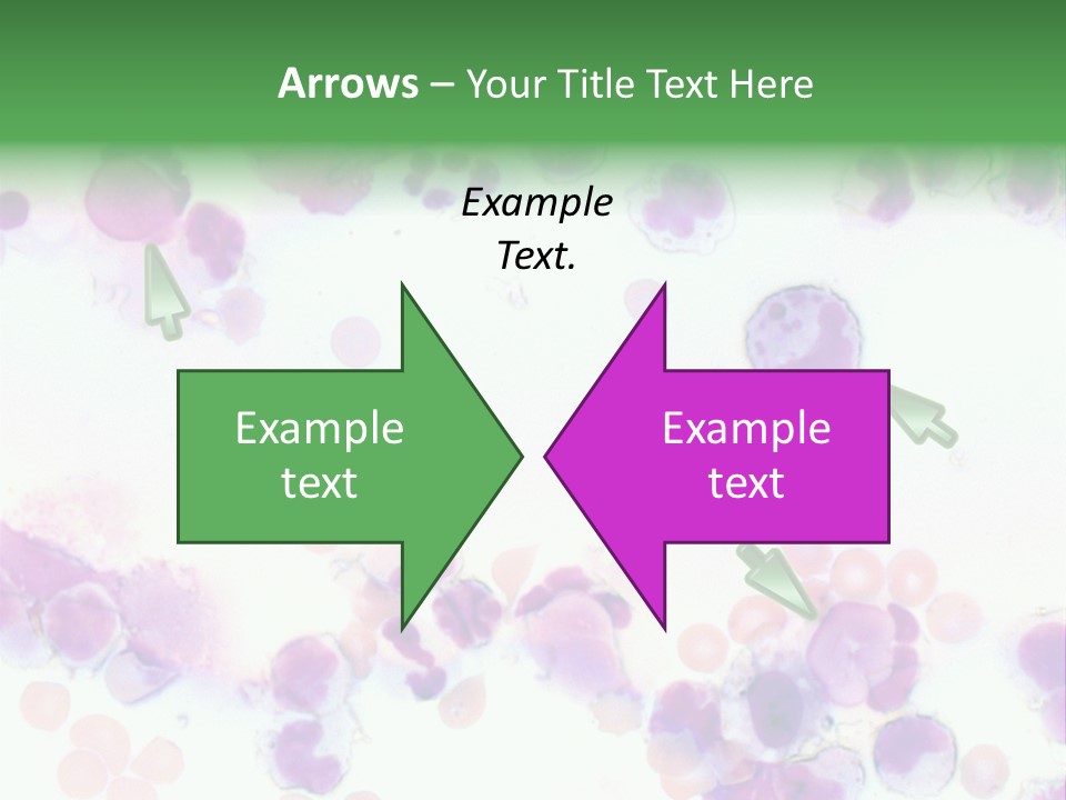 Fluid Antinuclear Sle PowerPoint Template