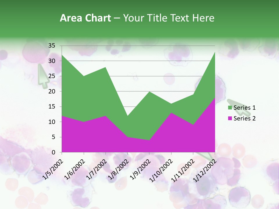 Fluid Antinuclear Sle PowerPoint Template