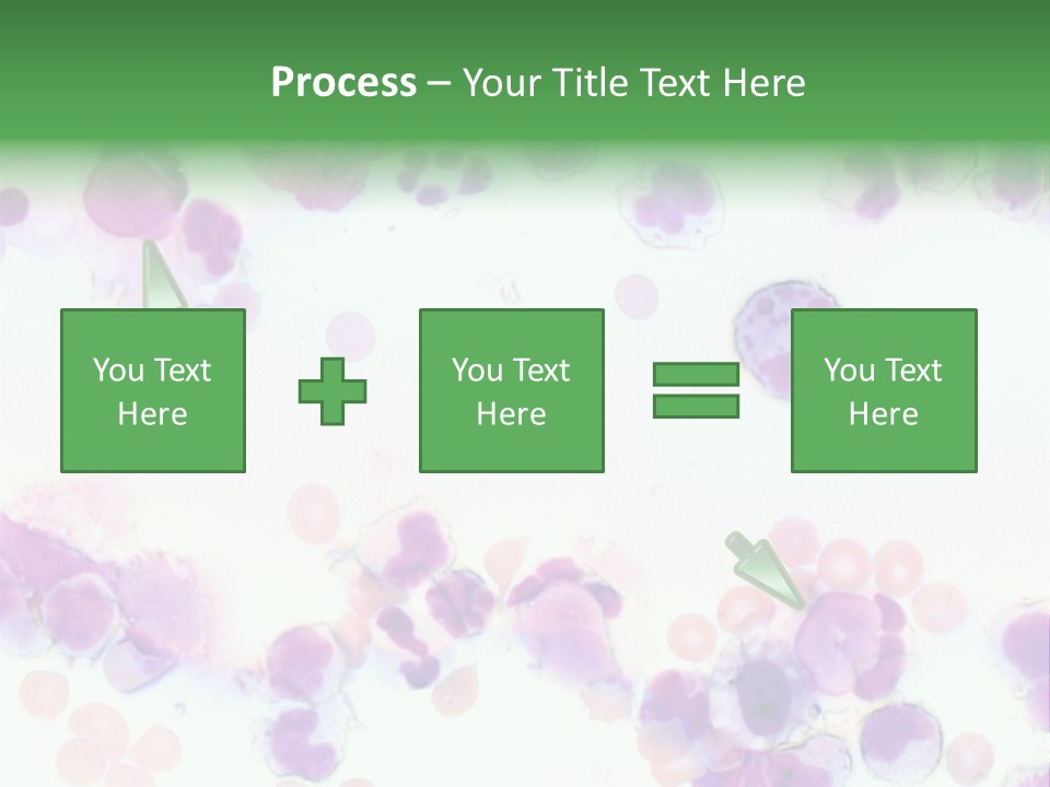 Fluid Antinuclear Sle PowerPoint Template