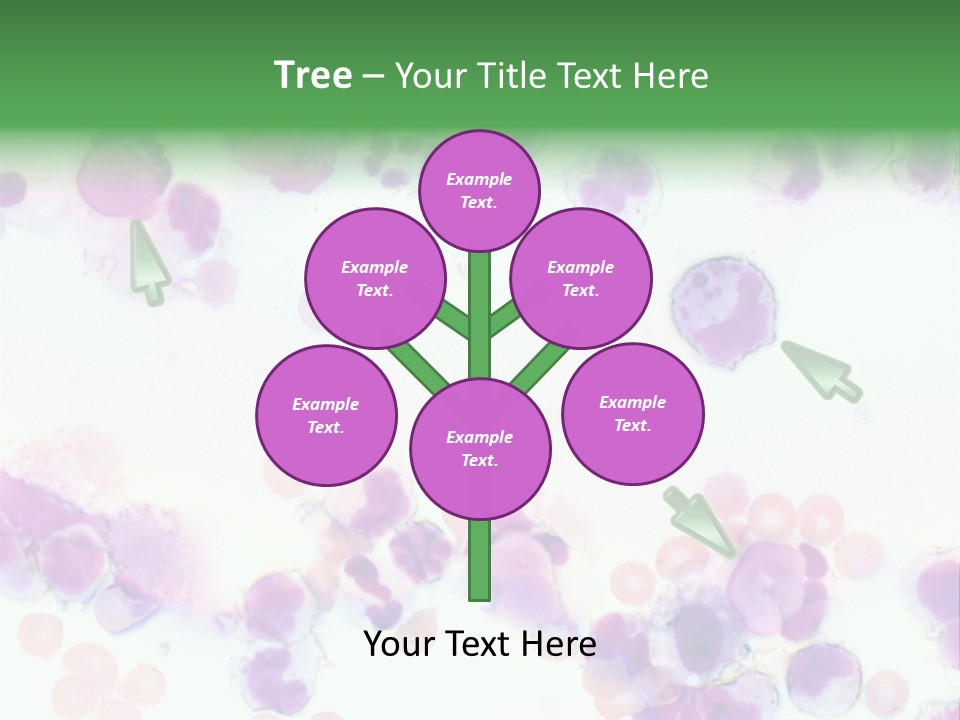 Fluid Antinuclear Sle PowerPoint Template