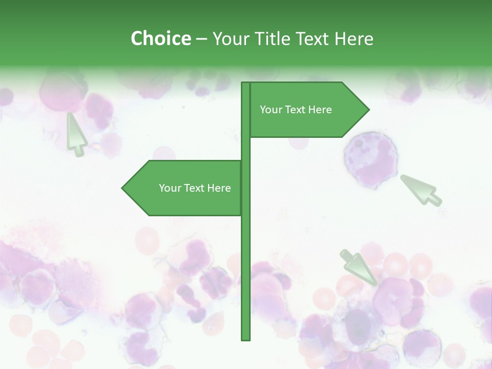 Fluid Antinuclear Sle PowerPoint Template