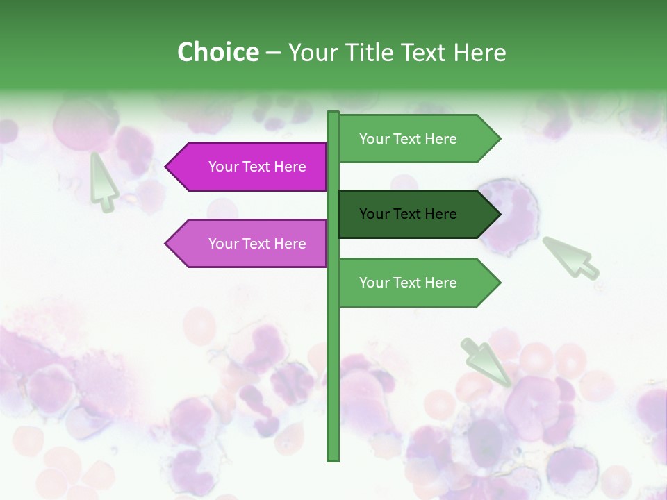 Fluid Antinuclear Sle PowerPoint Template