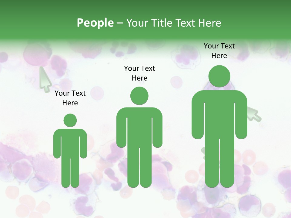 Fluid Antinuclear Sle PowerPoint Template