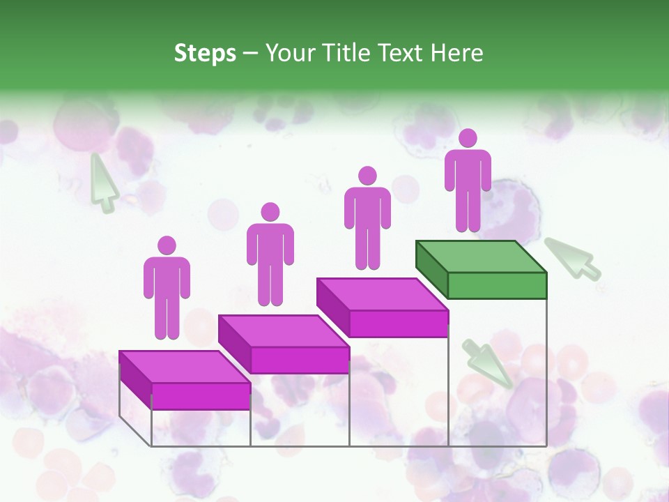 Fluid Antinuclear Sle PowerPoint Template