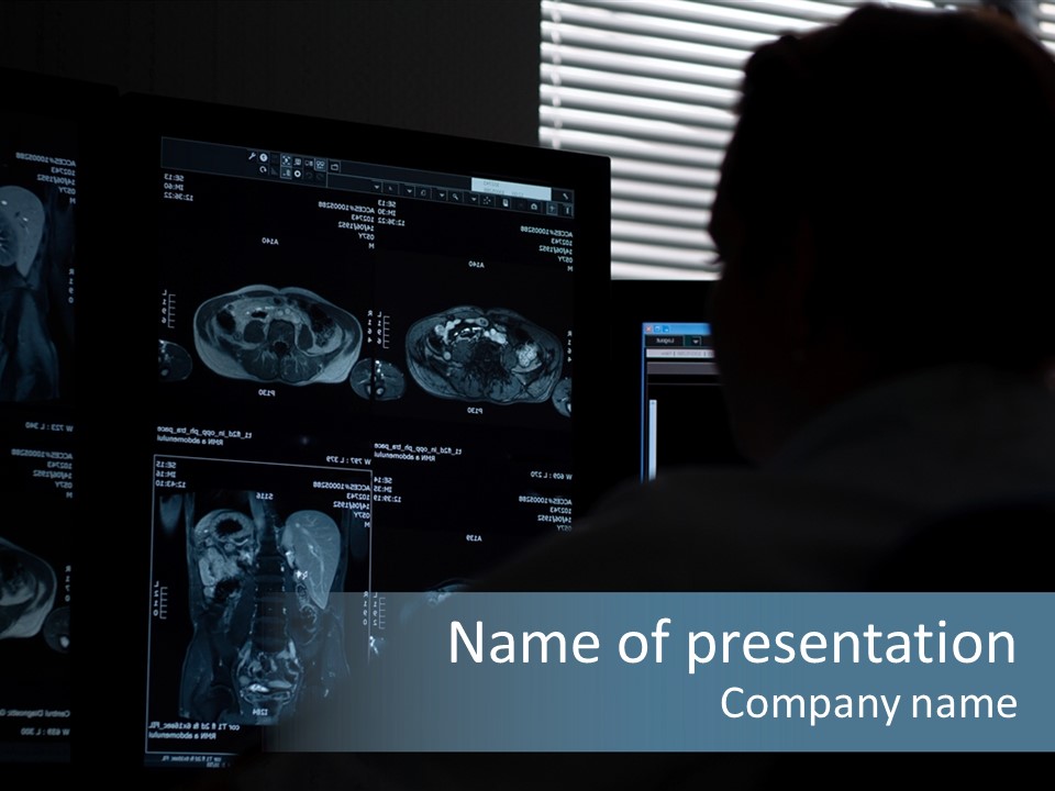 Cancer Anatomy Ray PowerPoint Template