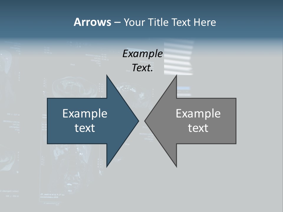 Cancer Anatomy Ray PowerPoint Template
